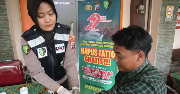 Polres Situbondo Beri Layanan Hapus Tato Gratis di HUT Bhayangkara ke-79